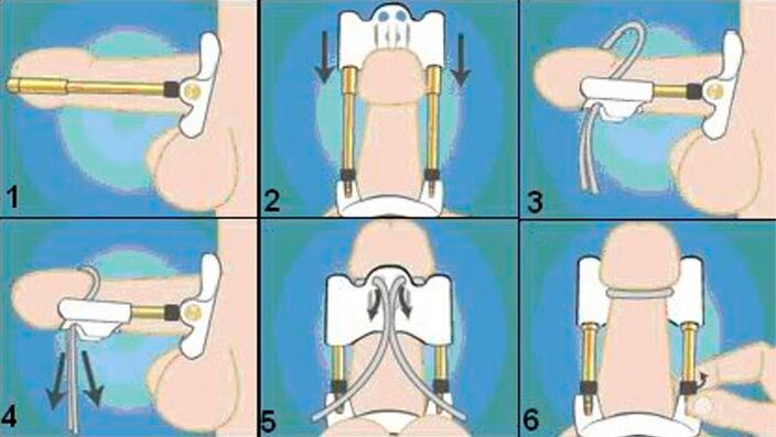 The final technology